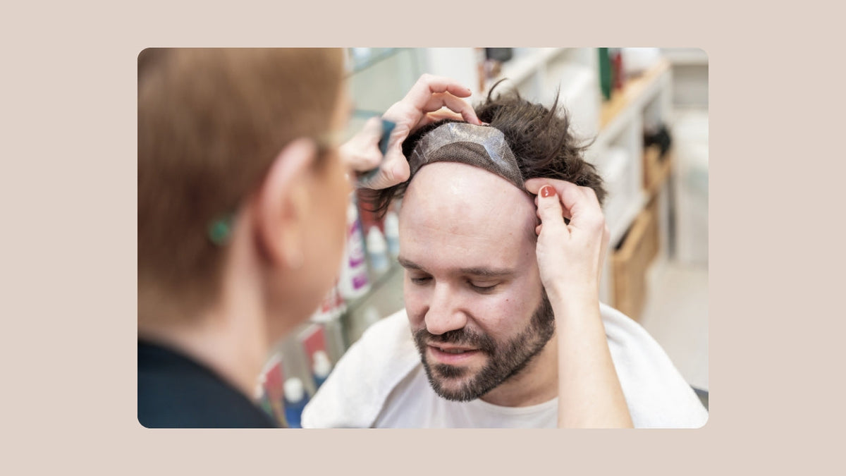 Prothèse capillaire pour homme : la solution moderne contre la calvitie