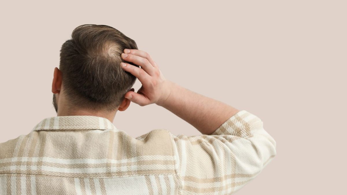 Complément capillaire pour homme : la solution idéale contre la calvitie